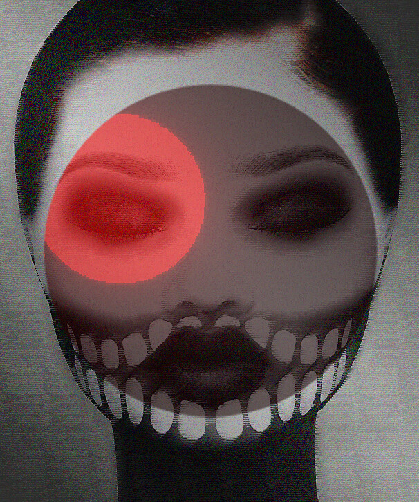 X-ray